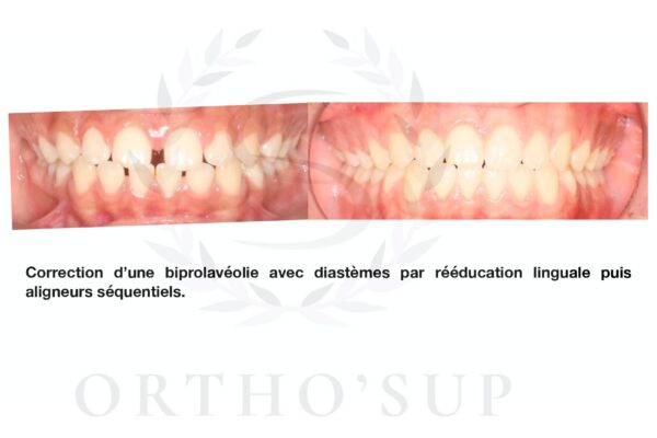 Galerie site ortho'sup_compressed_page-0009