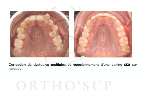 Galerie site ortho'sup_compressed_page-0010