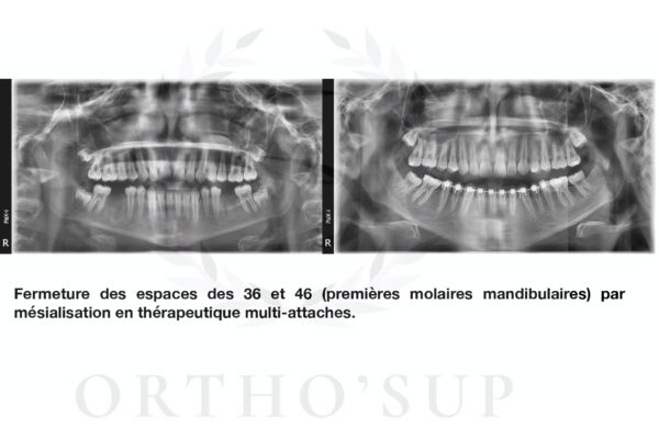 Galerie site ortho'sup_compressed_page-0014