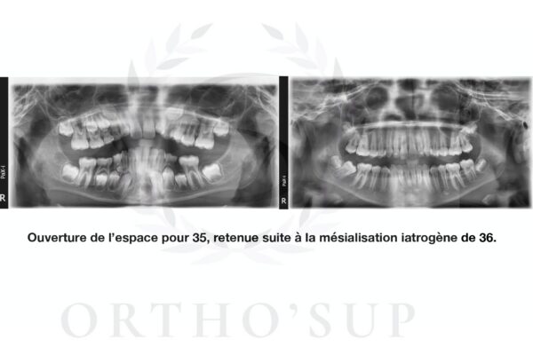 Galerie site ortho'sup_compressed_page-0015