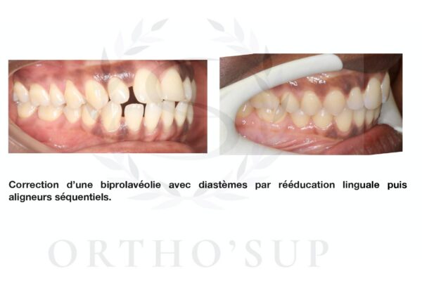 Galerie site ortho'sup_compressed_page-0016