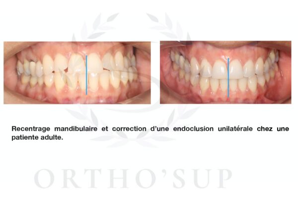 Galerie site ortho'sup_compressed_page-0017