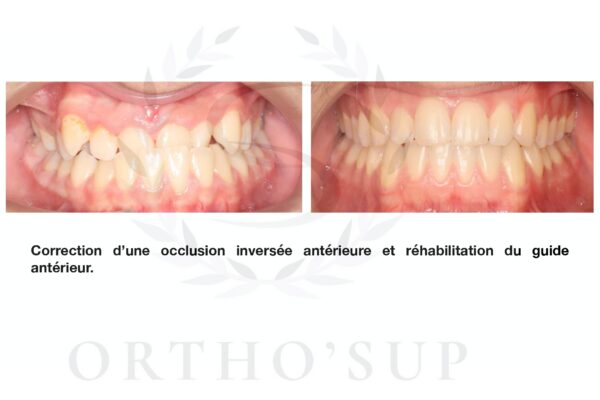 Galerie site ortho'sup_compressed_page-0018