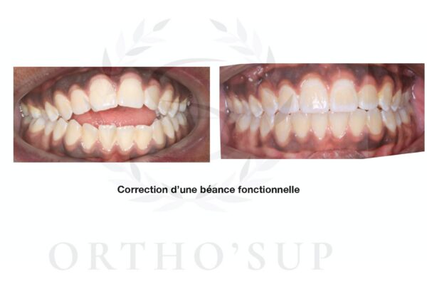 Galerie site ortho'sup_compressed_page-0019