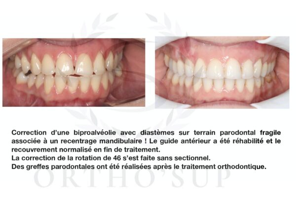 Galerie site ortho'sup_compressed_page-0024