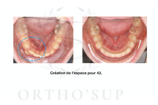 Galerie site ortho'sup_compressed_page-0026