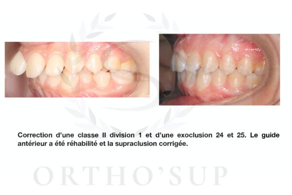 Galerie site ortho'sup_compressed_page-0029