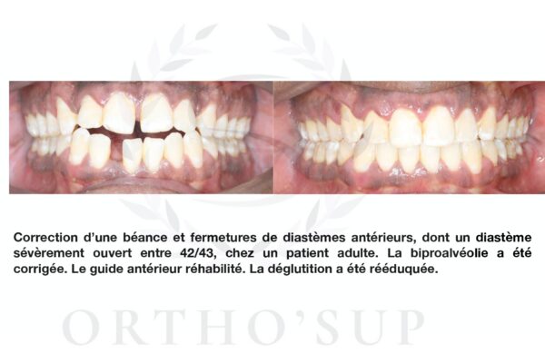 Galerie site ortho'sup_compressed_page-0034