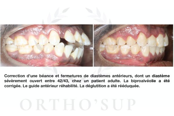 Galerie site ortho'sup_compressed_page-0035