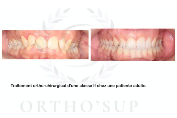 Galerie site ortho'sup_compressed_page-0037