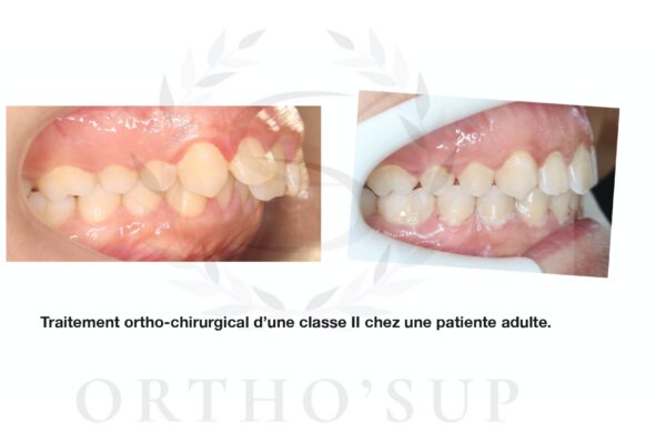 Galerie site ortho'sup_compressed_page-0038