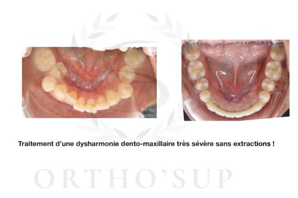 Galerie site ortho'sup_compressed_page-0044