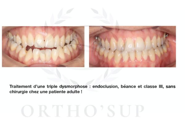 Galerie site ortho'sup_compressed_page-0046