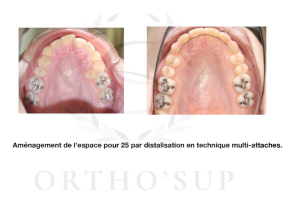 Galerie site ortho'sup_compressed_page-0048