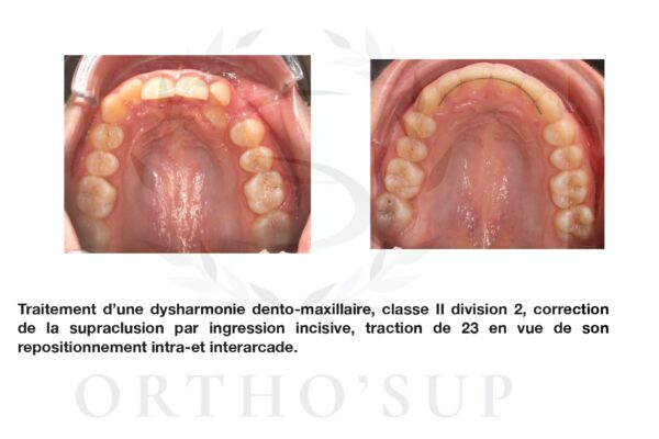 Galerie site ortho'sup_compressed_page-0051