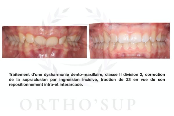 Galerie site ortho'sup_compressed_page-0052