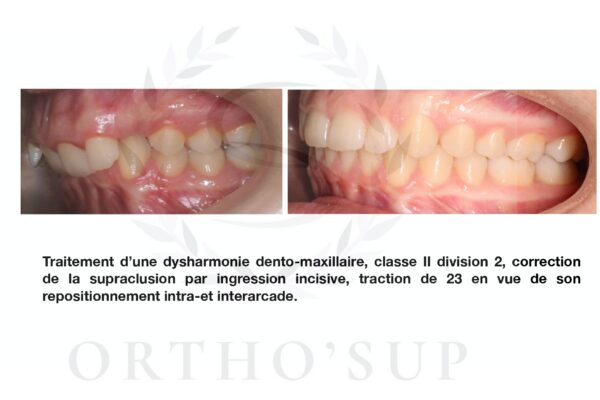 Galerie site ortho'sup_compressed_page-0053