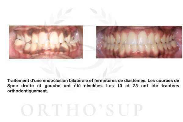 Galerie site ortho'sup_compressed_page-0057