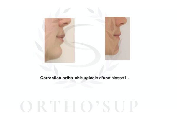 Galerie site ortho'sup_compressed_page-0059