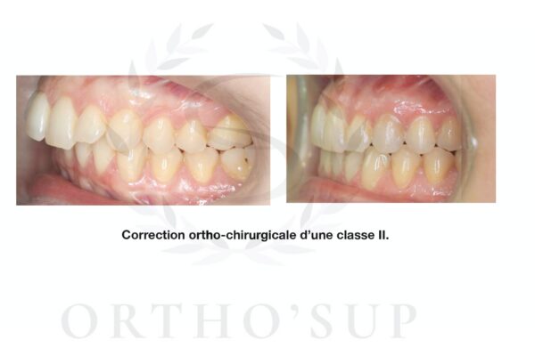 Galerie site ortho'sup_compressed_page-0060