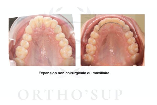 Galerie site ortho'sup_compressed_page-0061