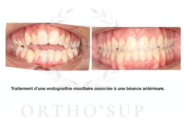 Galerie site ortho'sup_compressed_page-0065