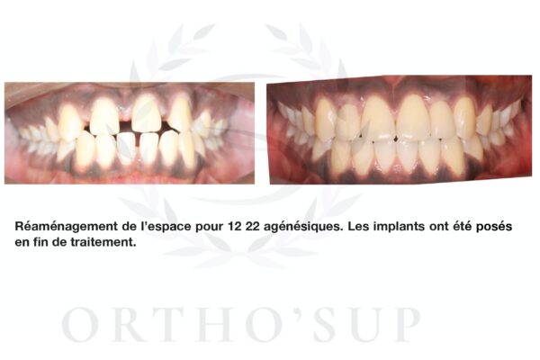 Galerie site ortho'sup_compressed_page-0066