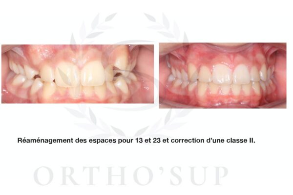 Galerie site ortho'sup_compressed_page-0068