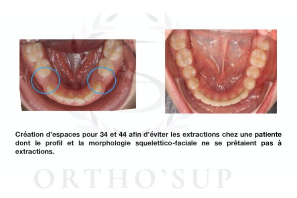 Galerie site ortho'sup_compressed_page-0072