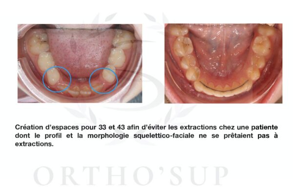 Galerie site ortho'sup_compressed_page-0073