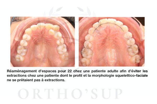 Galerie site ortho'sup_compressed_page-0074