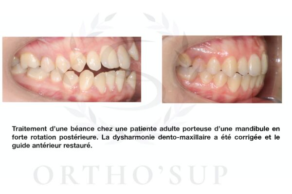 Galerie site ortho'sup_compressed_page-0076