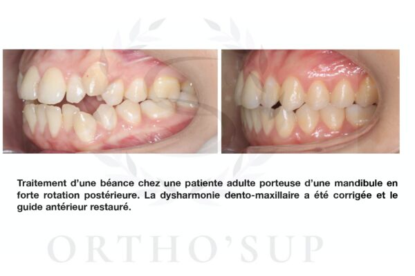 Galerie site ortho'sup_compressed_page-0077