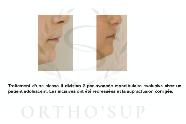 Galerie site ortho'sup_compressed_page-0078