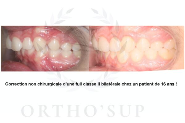 Galerie site ortho'sup_compressed_page-0080